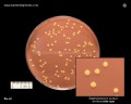 staphylococcus aureus chocolate agar