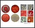 s.aureus, golden staph