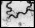 Borrelia burgdorferi TEM