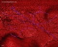 Borrelia red background