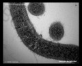 borrelia micrograph, transmission