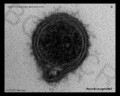 Borrelia burgdorferi section
