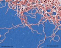 Borrelia burgdorferi cause of borreliosis