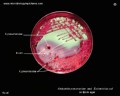klebsiella pneumoniae on Endo plate