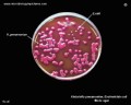 klebsiella pneumoniae and e.coli on Endo