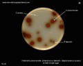 klebsiella pneumoniae and enterococcus esculin hydrolysis