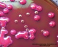 colony appearance of klebsiella pneumoniae on Endo