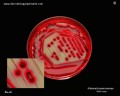 klebsiella pneumoniae growth characteristics on Endo