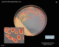 klebsiella pneumoniae macconkey plate, Petri dish