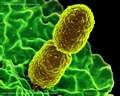 klebsiella pneumoniae SEM microscopy