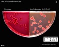 klebsiella pneumoniae growth characteristics on Endo and MacConkey