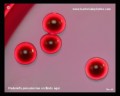 lactose positive colonies of klebsiella pneumoniae on Endo