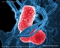 klebsiella pneumoniae SEM micrograph