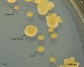 klebsiella pneumoniae, e.coli, enterococcus faecalis on CLED