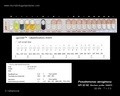 identification of pseudomonas aeruginosa with api 20 NE