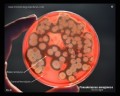 pseudomonas aeruginosa