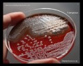 pseudomonas aeruginosa