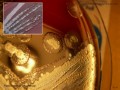 pseudomonas aeruginosa