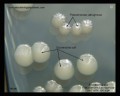 p.aeruginosa colony morphology