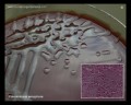 pseudomonas aeruginosa
