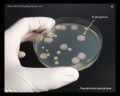 pseudomonas aeruginosa