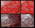 pseudomonas aeruginosa