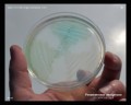 pseudomonas aeruginosa
