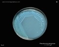 pseudomonas aeruginosa