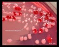 pseudomonas aeruginosa