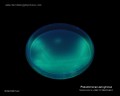 pseudomonas aeruginosa