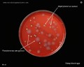 pseudomonas aeruginosa