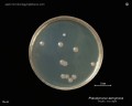 pseudomonas aeruginosa