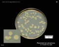 pseudomonas aeruginosa