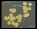 p.aeruginosa green colonies
