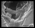 pseudomonas aeruginosa