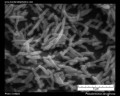 pseudomonas aeruginosa