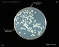 pseudomonas aeruginosa