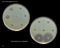 stenotrophomonas maltophilia
