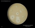 stenotrophomonas maltophilia