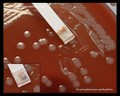 stenotrophomonas maltophilia