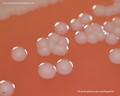 stenotrophomonas maltophilia