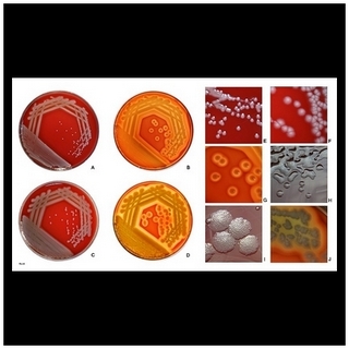 pseudomonas aeruginosa on agar