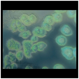 cetrimide agar pseudomonas
