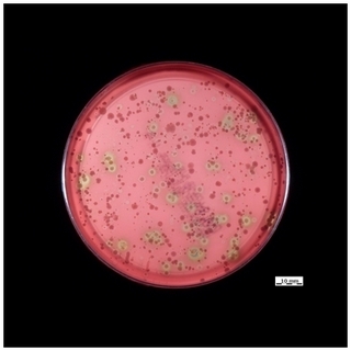 hemolysis on blood agar