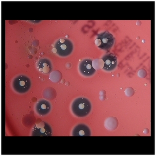 beta hemolysis, beta-hemolytic colonies