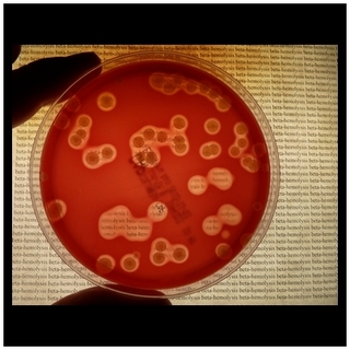 s.aureus hemolysis