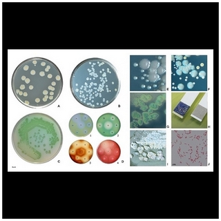 pseudomonas aeruginosa pigment