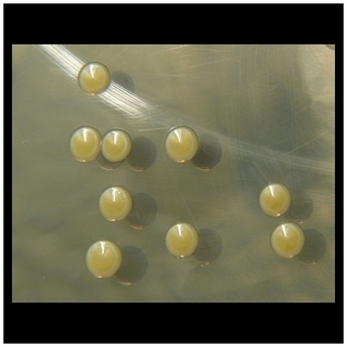 yellow pigment in staphylococcus aureus
