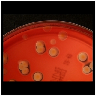 Streptococcus agalactia colony, Staphylococcus aureus colony