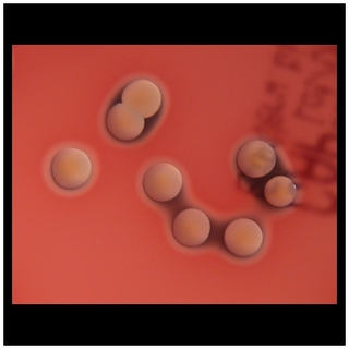 s.aureus colonies